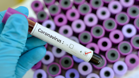 Querétaro confirma 4 casos de Coronavirus. Foto: Internet.