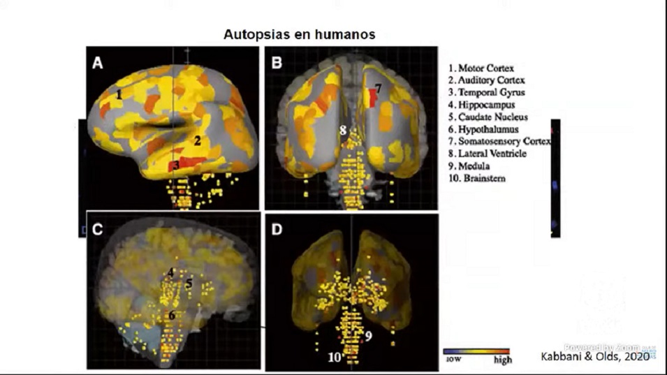 Revelan científicos que COVID-19 deja secuelas en el cerebro.