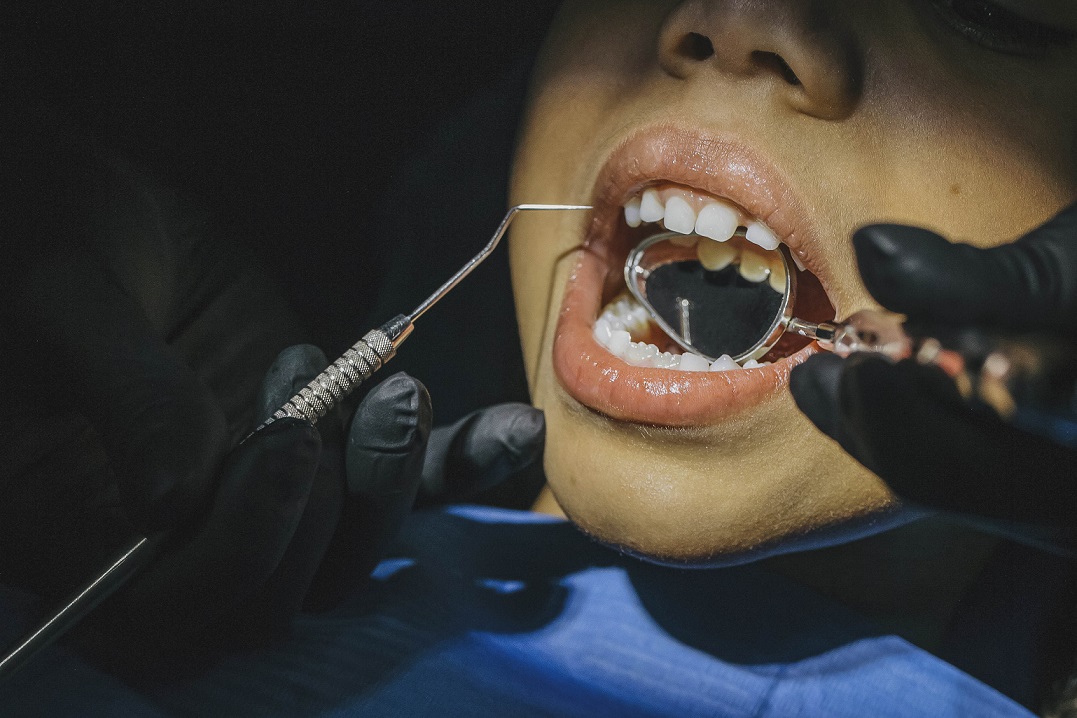 La lucha contra las caries debe ser desde el nacimiento; expertos de la UNAM.