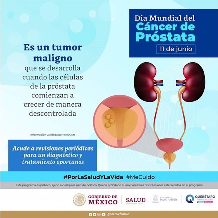 Estos son los síntomas del cáncer de próstata