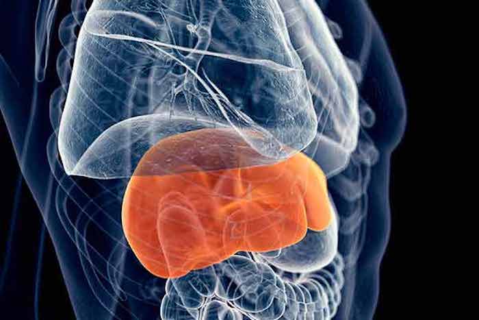 La hepatitis puede evolucionar a cáncer hepático